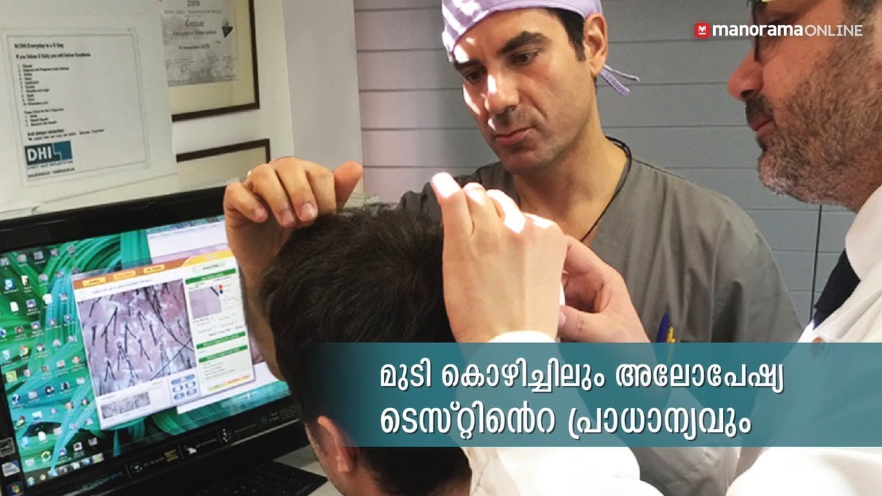 മുടി കൊഴിച്ചിലും അലോപേഷ്യ ടെസ്റ്റിന്റെ പ്രാധാന്യവും | Importance of diagnosis & alopecia test