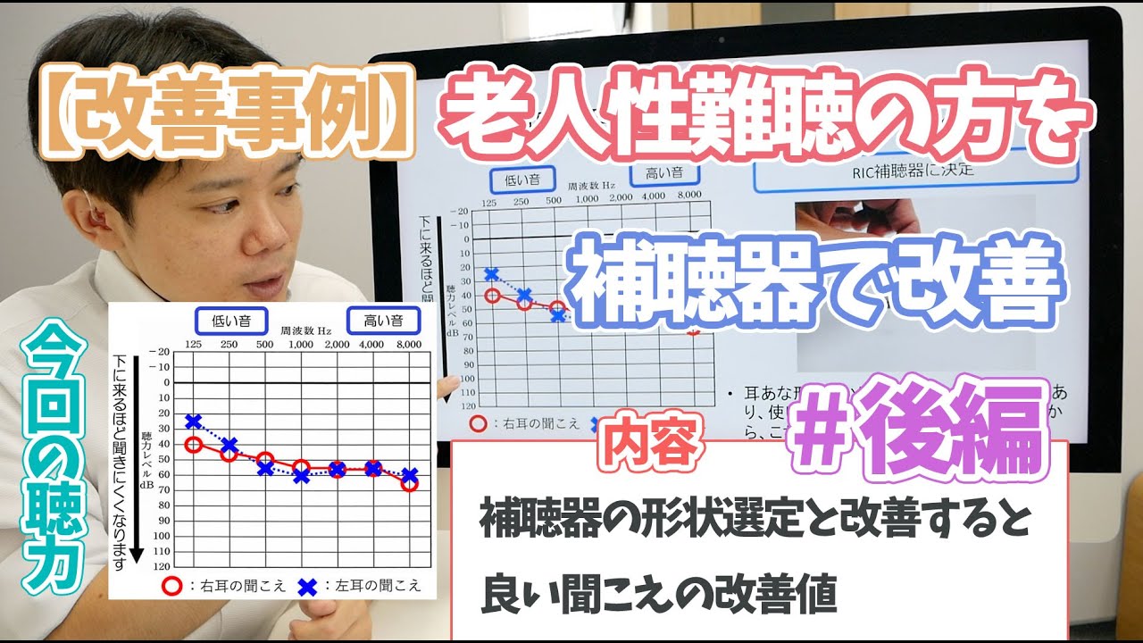 【改善事例】老人性難聴の方の聞こえを補聴器で改善した事例・後編　実際の補聴器の形状選定と聞こえの改善値