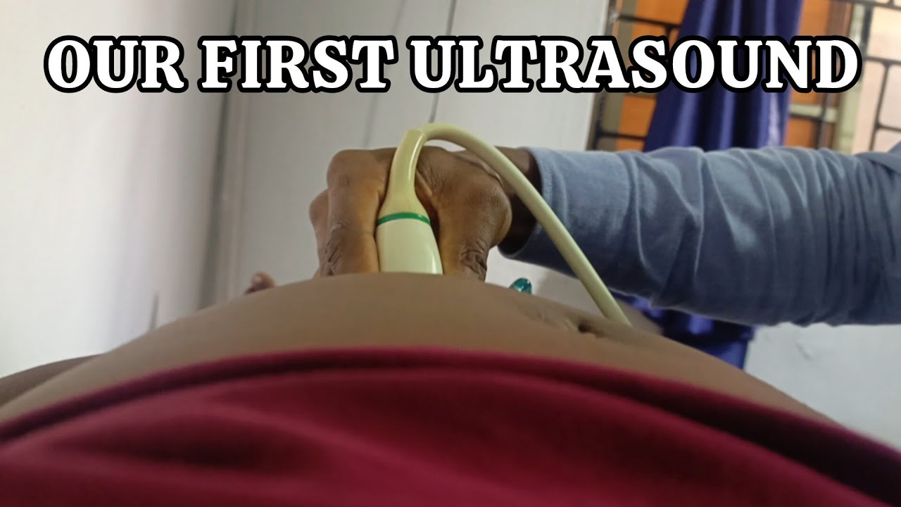 Our FIRST ULTRASOUND at 9 Weeks Pregnant🤰👶| Baby #2