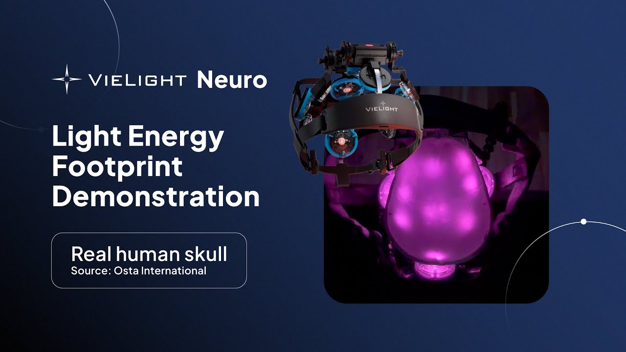 Vielight Neuro | Energy Footprint Demonstration on a Real Human Skull
