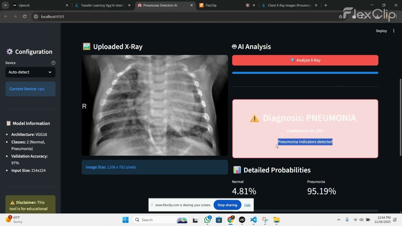 transfer learning-vgg16-chest-xray-pytorch