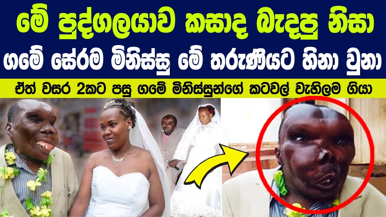 මේ පුද්ගලයාව කසාද බැදපු නිසා ගමේ සේරම මිනිස්සු මේ තරුණියට හිනා වුනා. ඒත් වසර 2කට පසු සිදු වූ දේ !