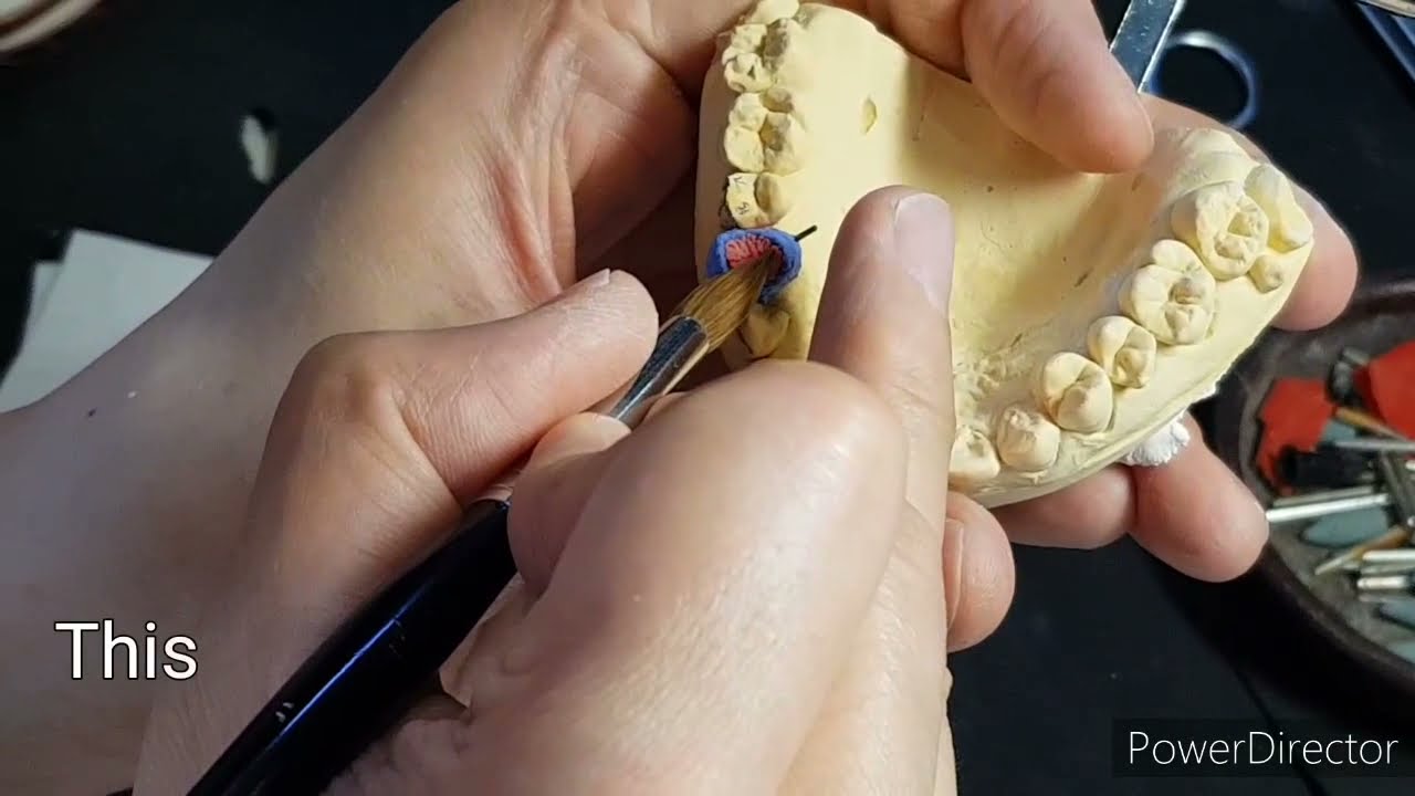 #소구치 #Premolar #상악 #Upper #빌드업 #Buildup Part 4.
