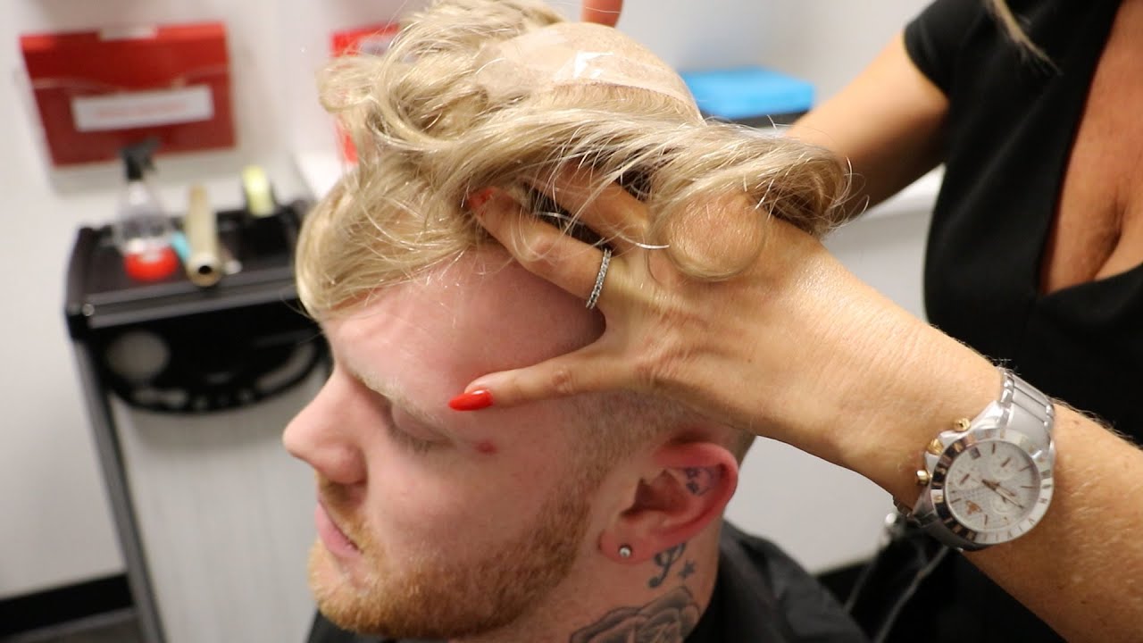 Mens Hair Replacement Systems - Before and After Transformation!