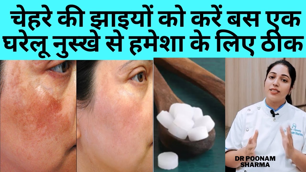 चेहरे की झाइयां और झुर्रियां मिटाने के घरेलु उपाय | Home Remedies To Remove  Wrinkles On face