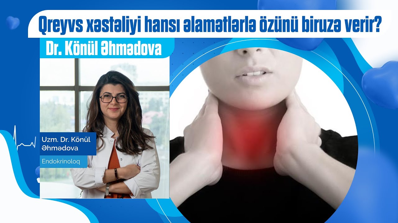 Qreyvs xəstəliyi hansı əlamətlərlə özünü biruzə verir?
