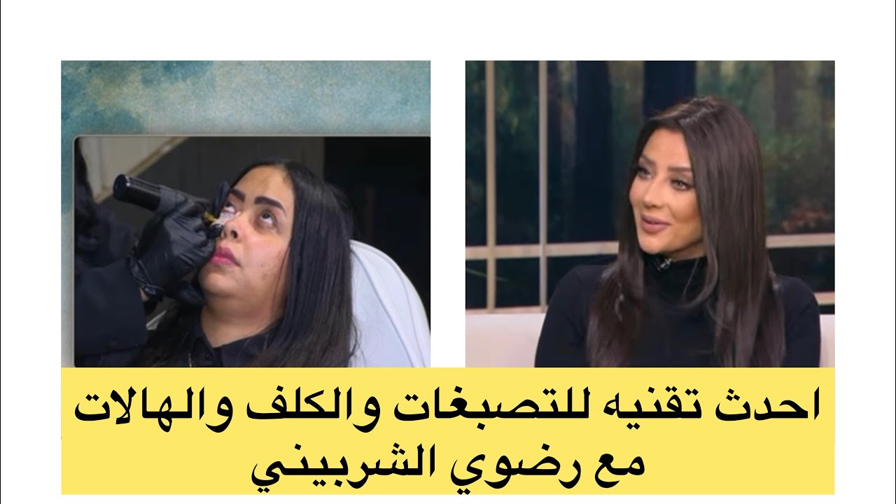 الكاموفلاج للتخلص من التصبغات والكلف والهالات السمراء #كلف #تفتيح #تجميل #هالات