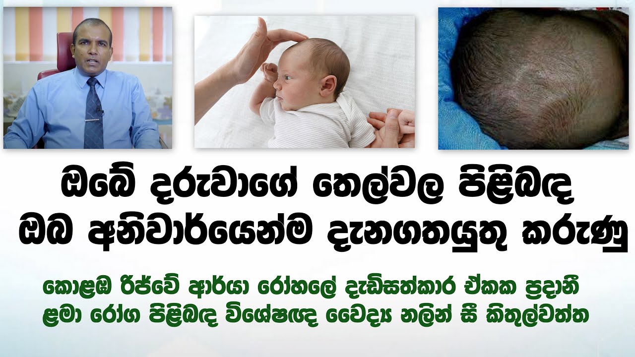 ඔබේ දරුවාගේ තෙල්වල පිළිබඳ ඔබ දැනගතයුතු කරුණු | anterior fontanelle | Dr. Nalin.c.kithulwaththa