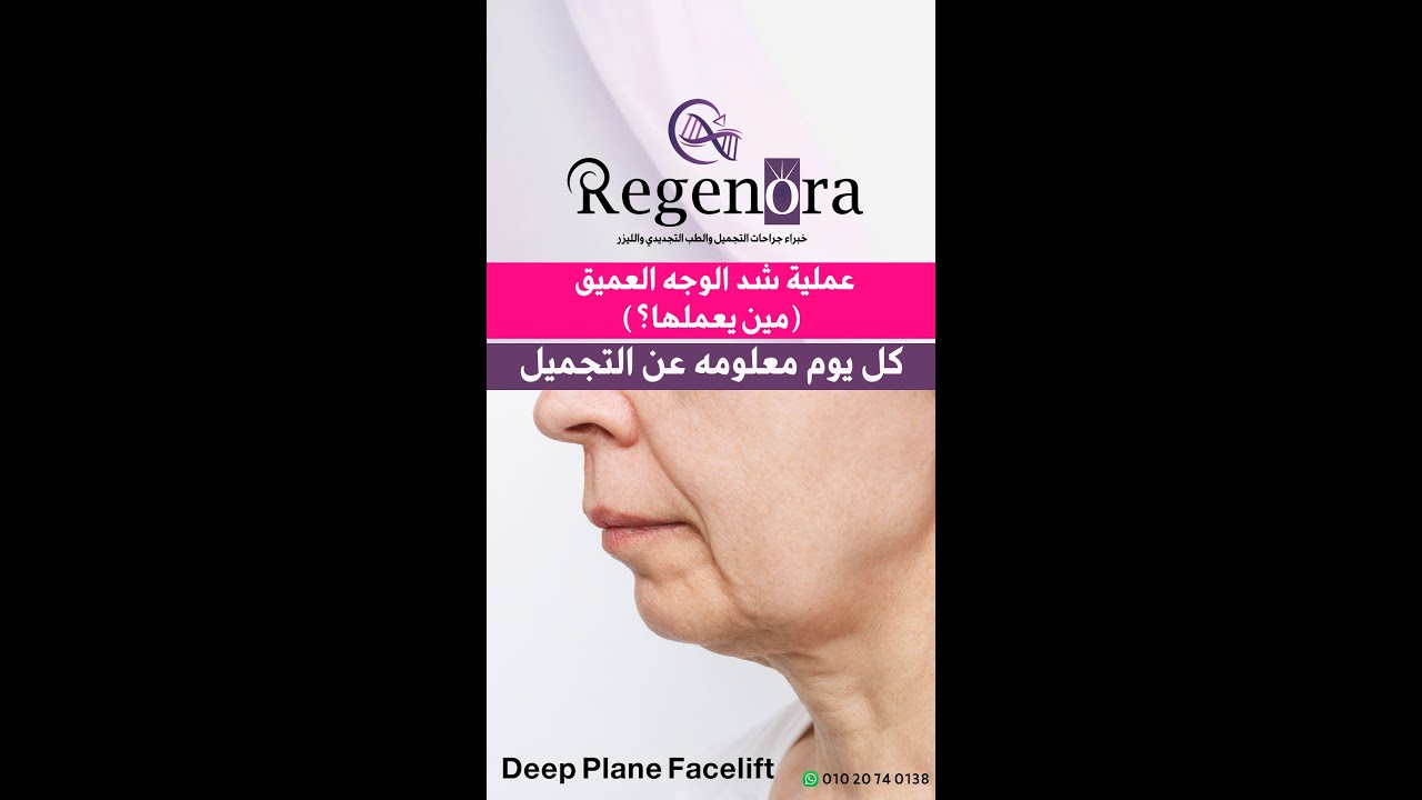 عملية شد الوجه العميق | كل ما تريد معرفته في 10 نقاط | Deep Plane Facelift