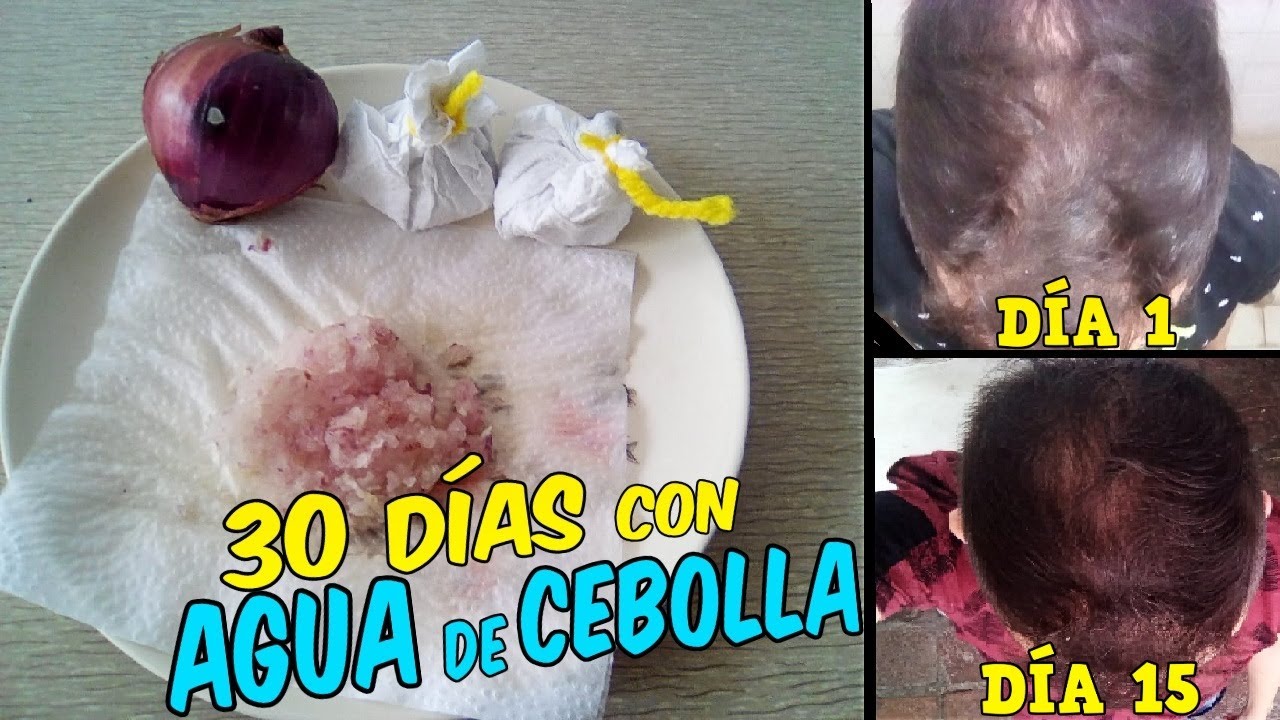 Usando CEBOLLA 1 Mes en el Cabello | Detiene la Caída? | Cabello Fuerte y Largo