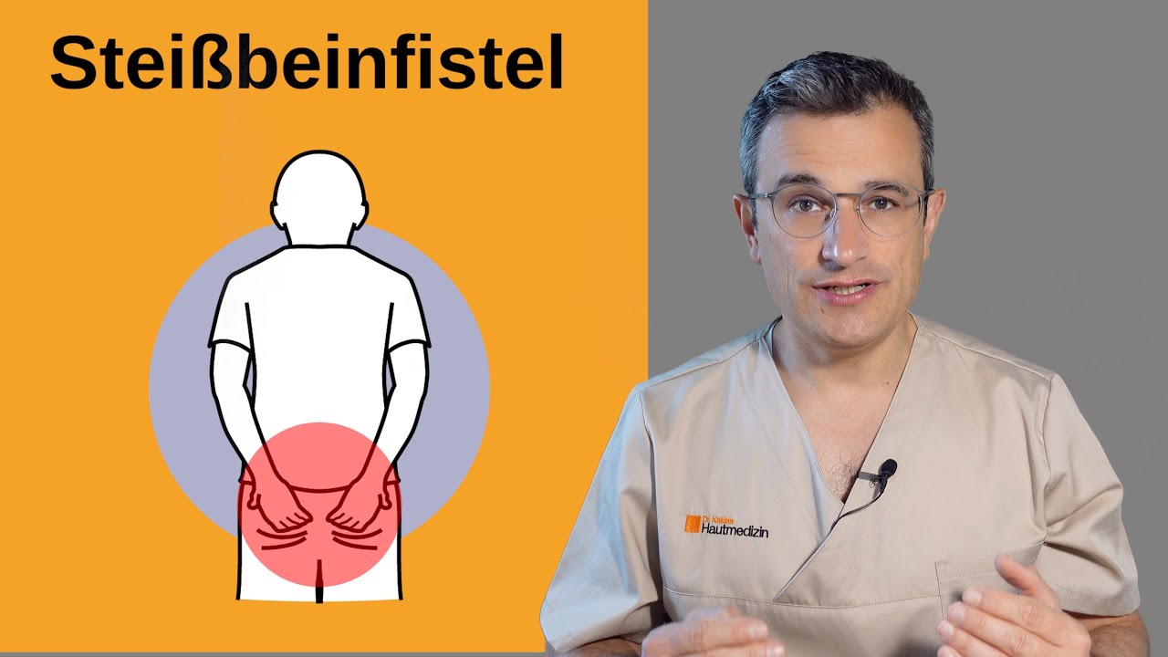 Steißbeinfistel: ohne OP mit Laser behandeln. Dr. Kasten Hautmedizin in Mainz