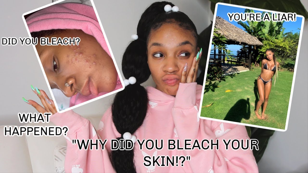 CHIT CHAT GRWM: let's talk about this... BLEACHING my skin? (BEFORE & AFTER)
