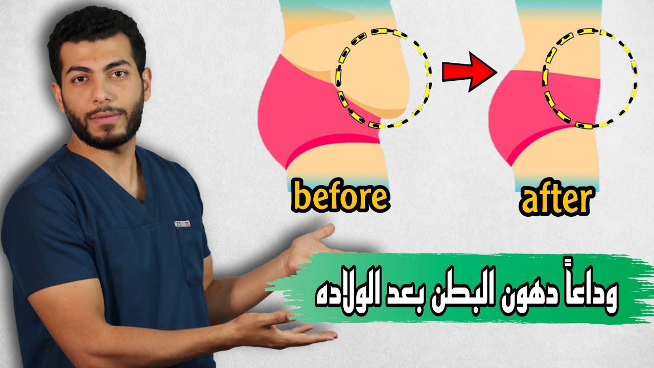 أسرع طريقة لتخسيس البطن و إزالة الكرش بعد الولادة القيصرية او الطبيعيه ولن تندمى