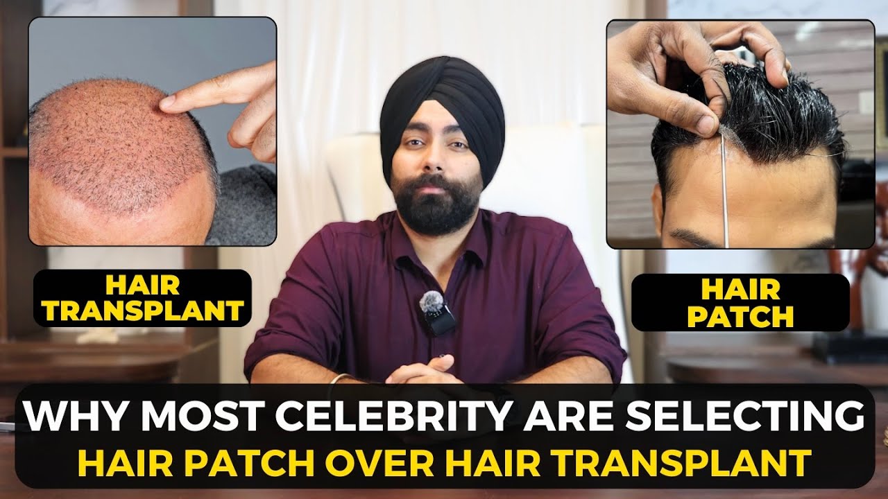 Hair Patch vs Hair transplant | Why most celebrity are choosing hair patch  | Hair wig house