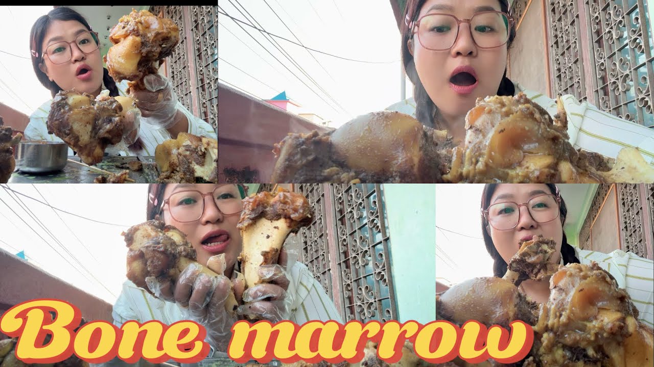 Bone marrow Rambazar Pokhara 📍keep supporting gys❤️❤️❤️✌️✌️✌️✌️✌️💕💕💞💞💞💞💞