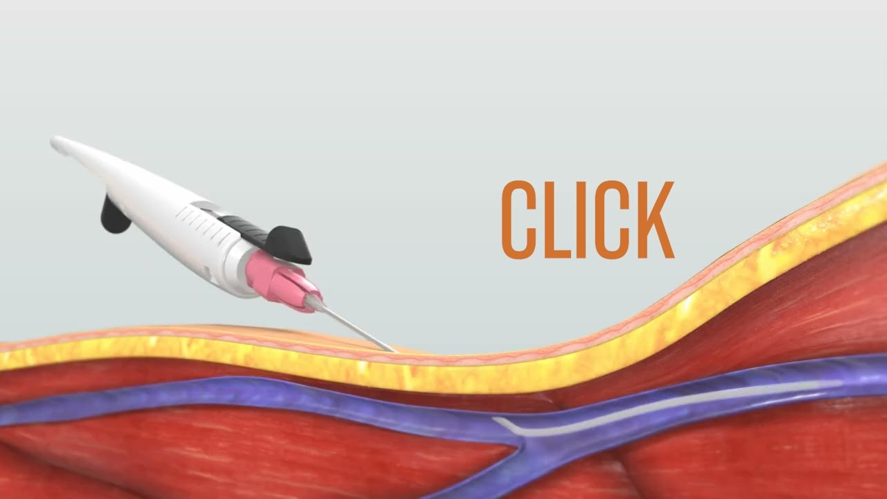 Medical Device 3D Animation Video | Piper Access - Stiletto