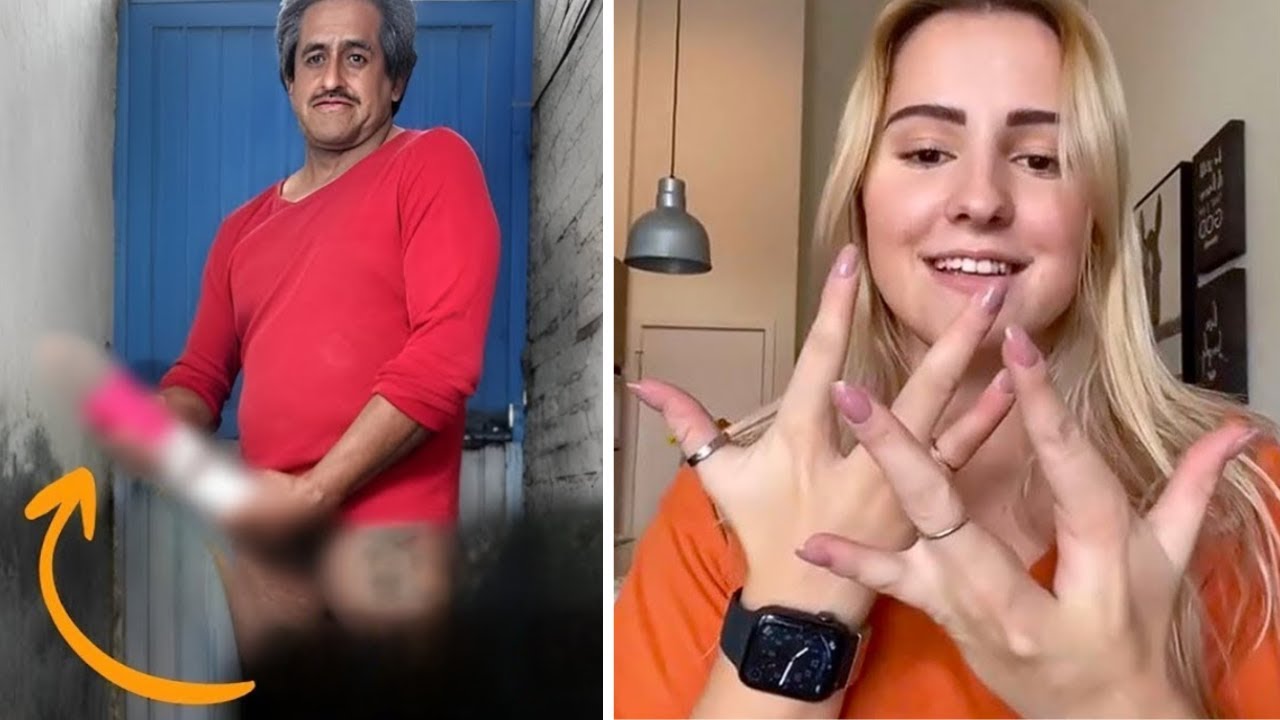 15 необычных людей с самыми странными частями тела