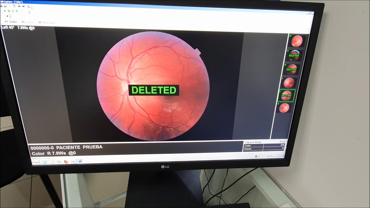 CÁMARA RETINAL TRC NW8 - TOPCON