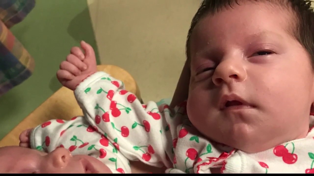 Conjoined twins discharged from hospital, headed to Idaho
