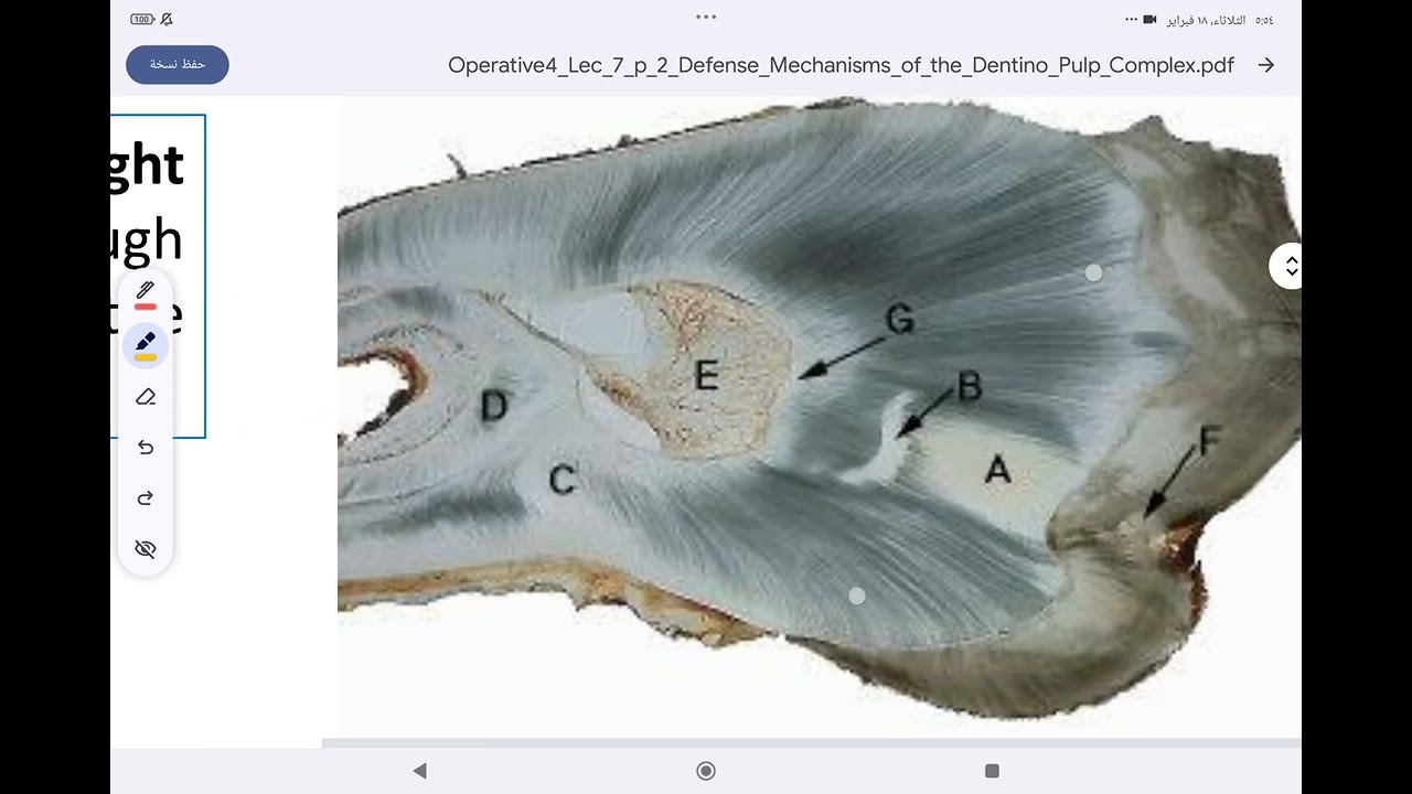 operative defense mechanism of the dentino-pulp complex مرحلة رابعة أسنان