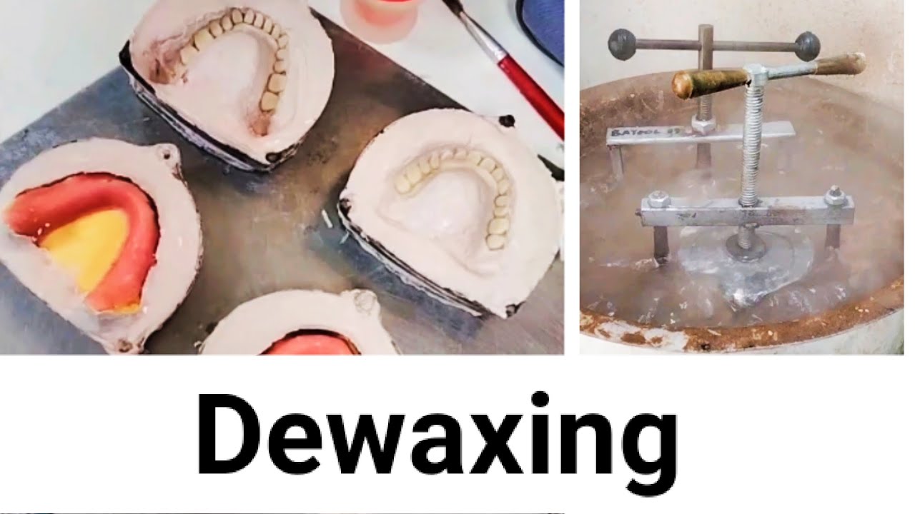 Step#13 Dewaxing #complete_denture