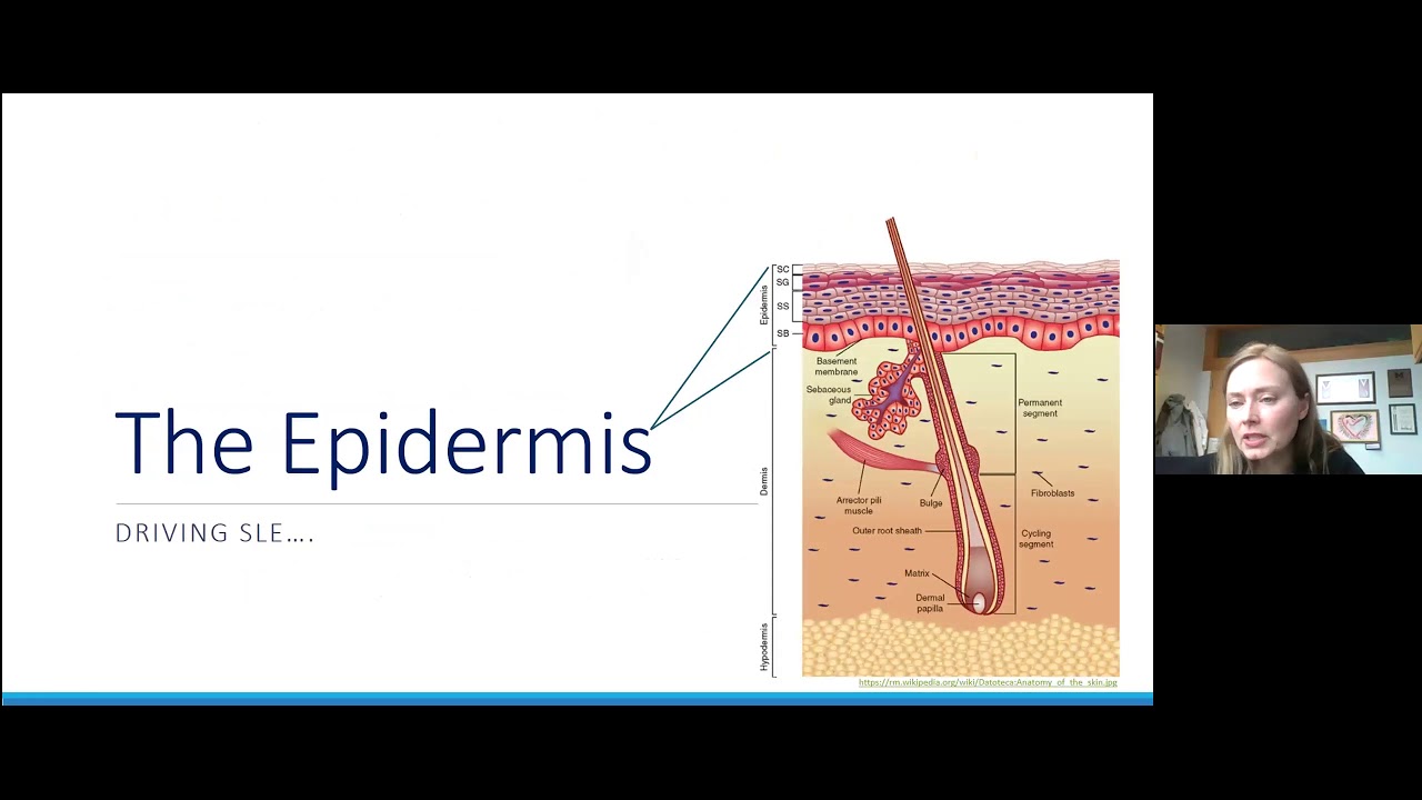 Global Derm Talks 1-25-21 J. Michelle Kahlenberg - The Pathogenesis of CLE
