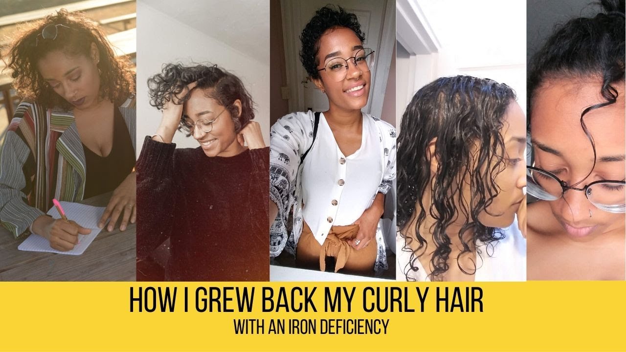Iron Deficiency Hair Loss Regrowth + How to grow back your Hair-ONE YEAR UPDATE