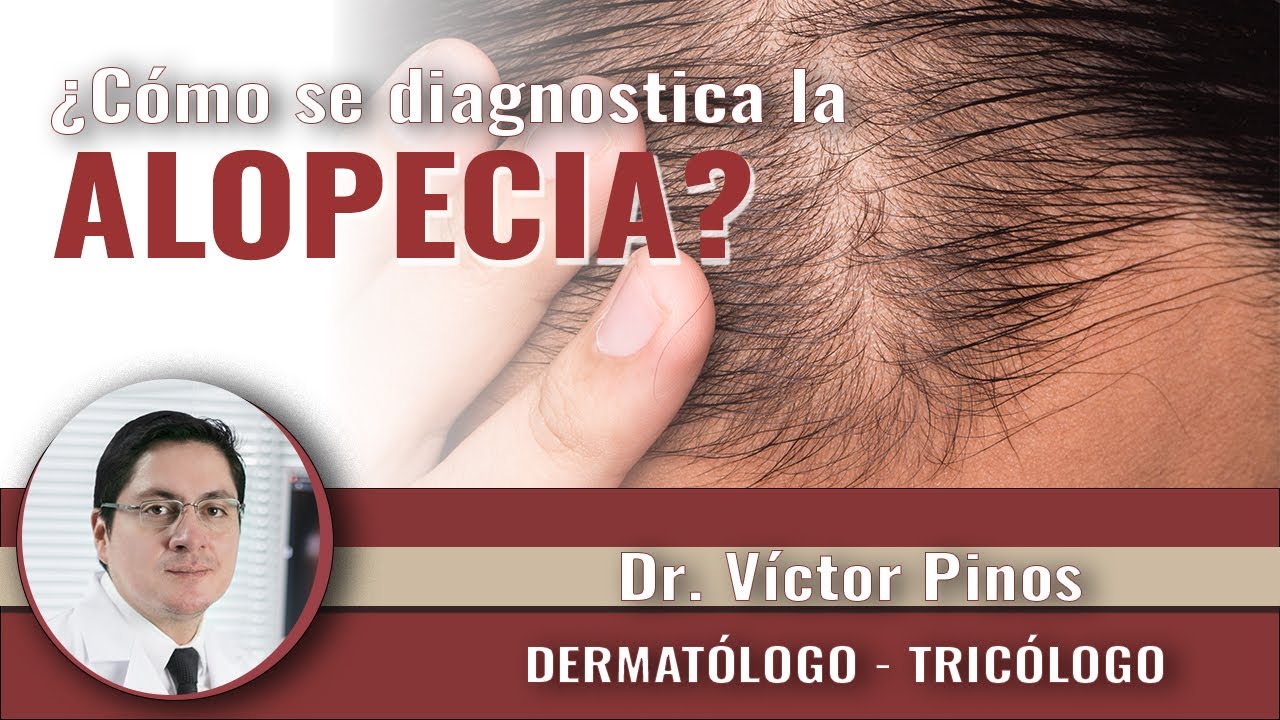 ALOPECIA || &iquest;C&oacute;mo tu DERMAT&Oacute;LOGO diagnostica la ALOPECIA ? || No pierdas m&aacute;s cabello