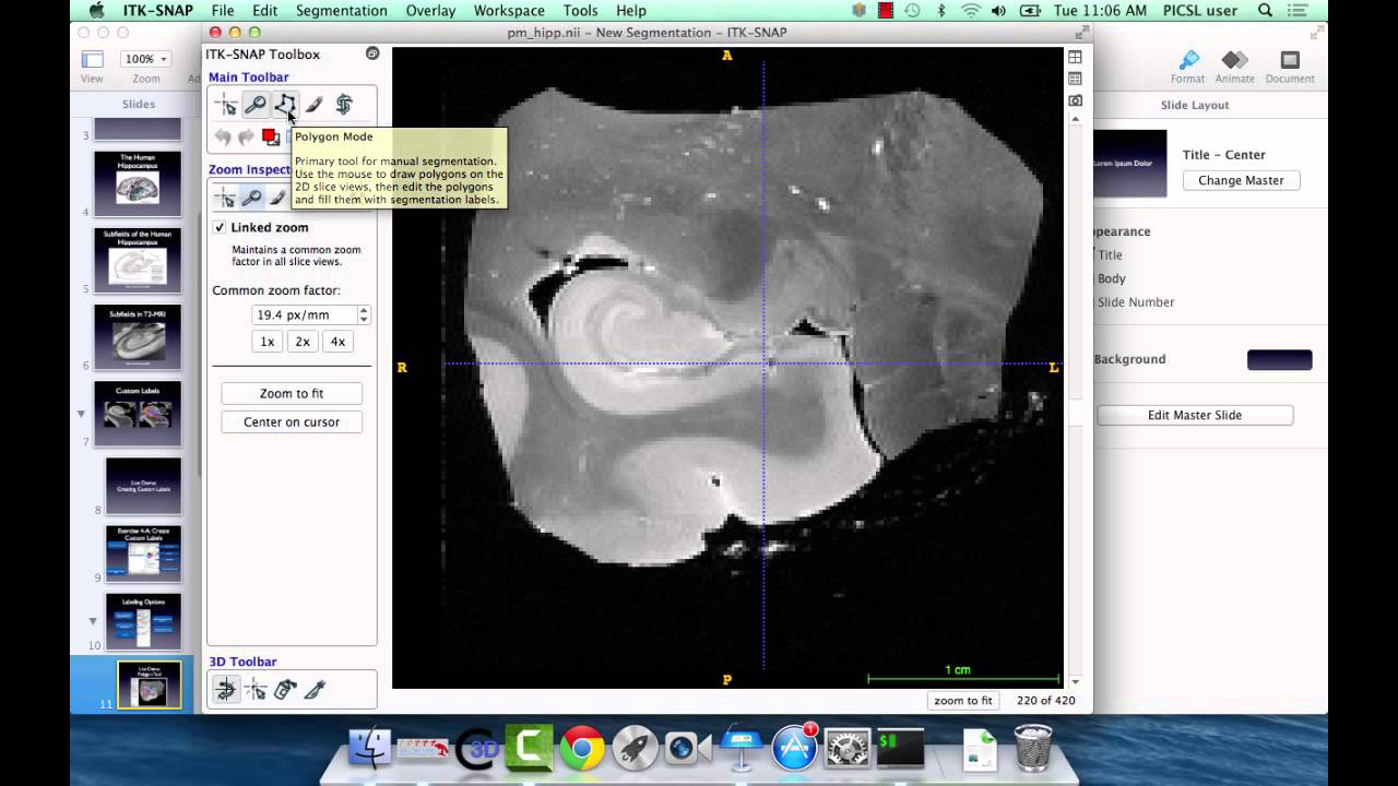 ITK-SNAP 3.2 User Training, Session 4: Manual Segmentation