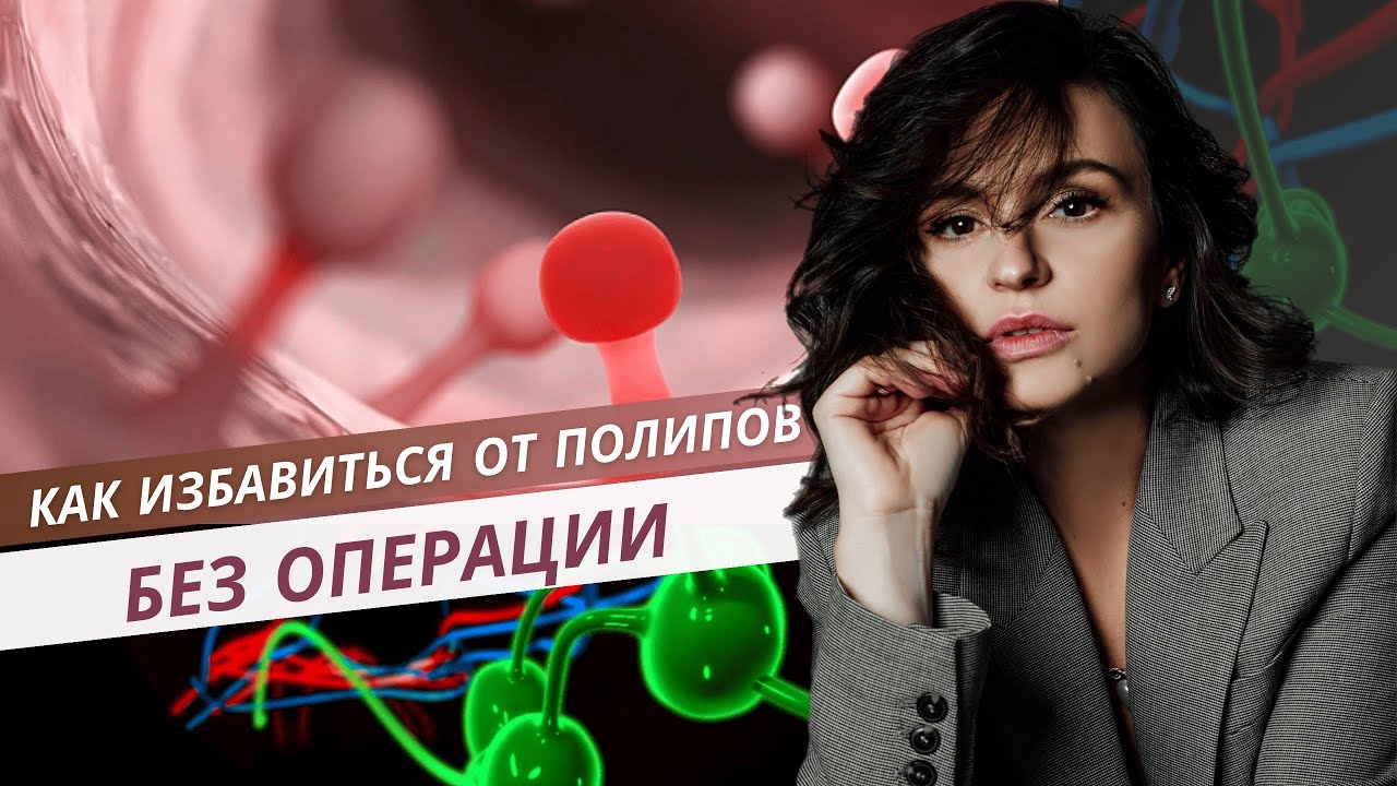 Как избавиться от полипов без операции?