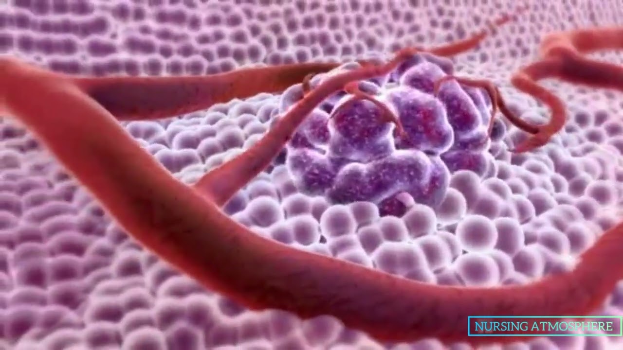 3d video @WHAT IS CANCER  @CancerMoonsTarot @jincenursing @drkkkarade
