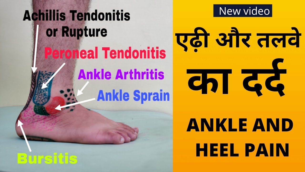 टखने, ऐडी और तलवे दर्द: कारण | Causes of Ankle and Heel Pain | Dr. Vivek Gaur (PT)