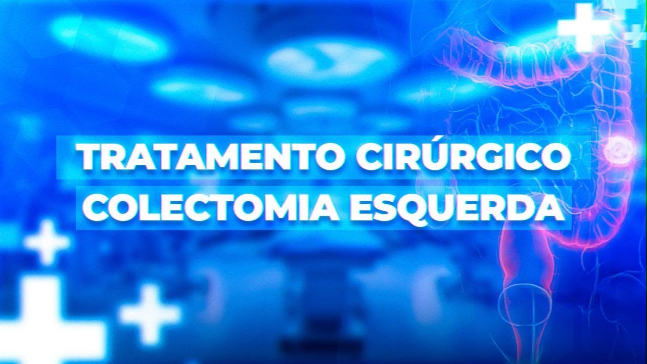 Colectomia Esquerda - Aspectos Técnicos e Prognósticos!
