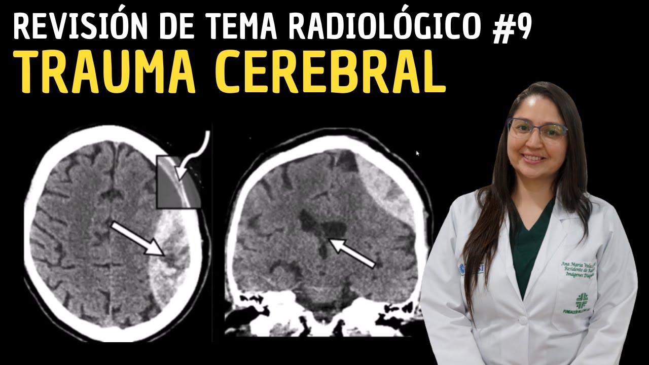 Revisión de Tema 9: Trauma Cerebral.