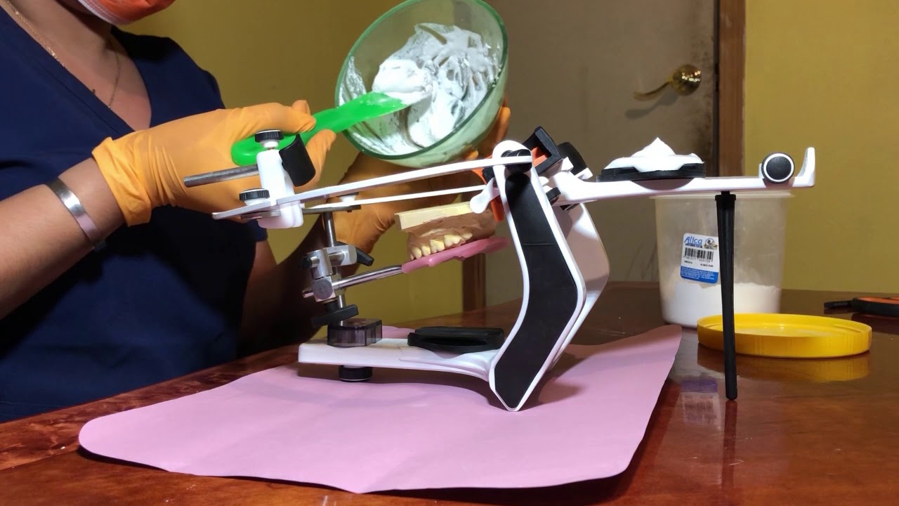 Montaje de modelo superior (Articulador semi ajustable)