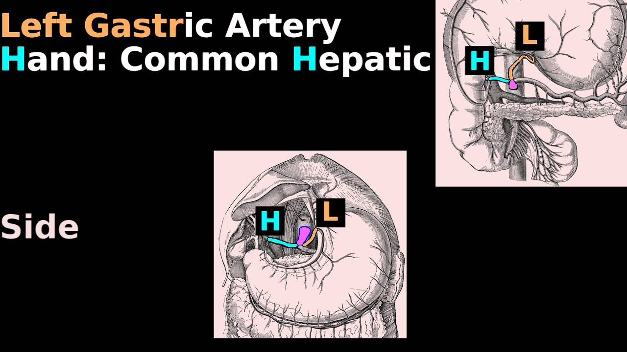 Celiac Trunk Anatomy Mnemonic: Abdomen Blood Supply tutorial: Gastric, Gastroepiploic, Lineal
