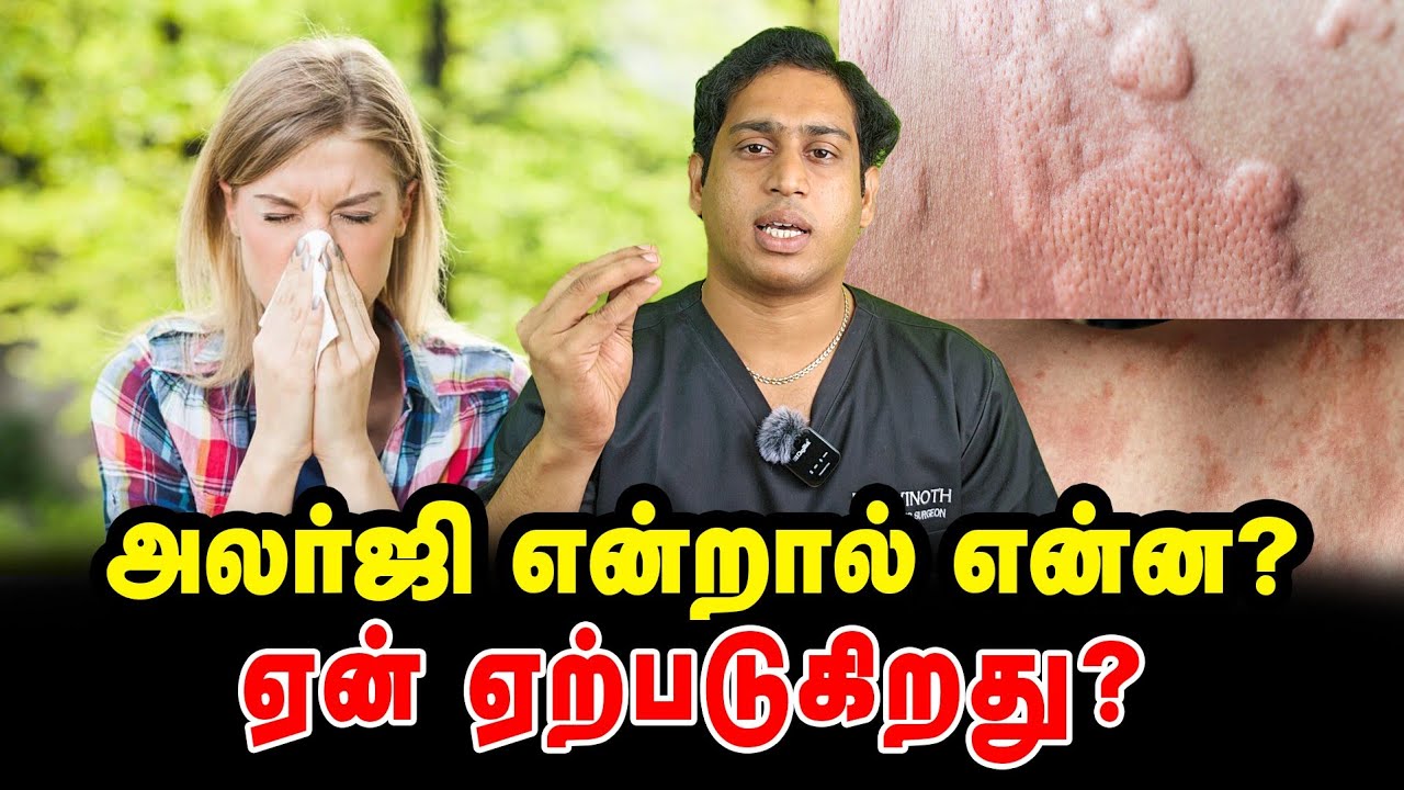 அலர்ஜி ஏற்பட காரணம்|Allergy types|Allergy causes|Hypersensitivity types|Different types of Allergy