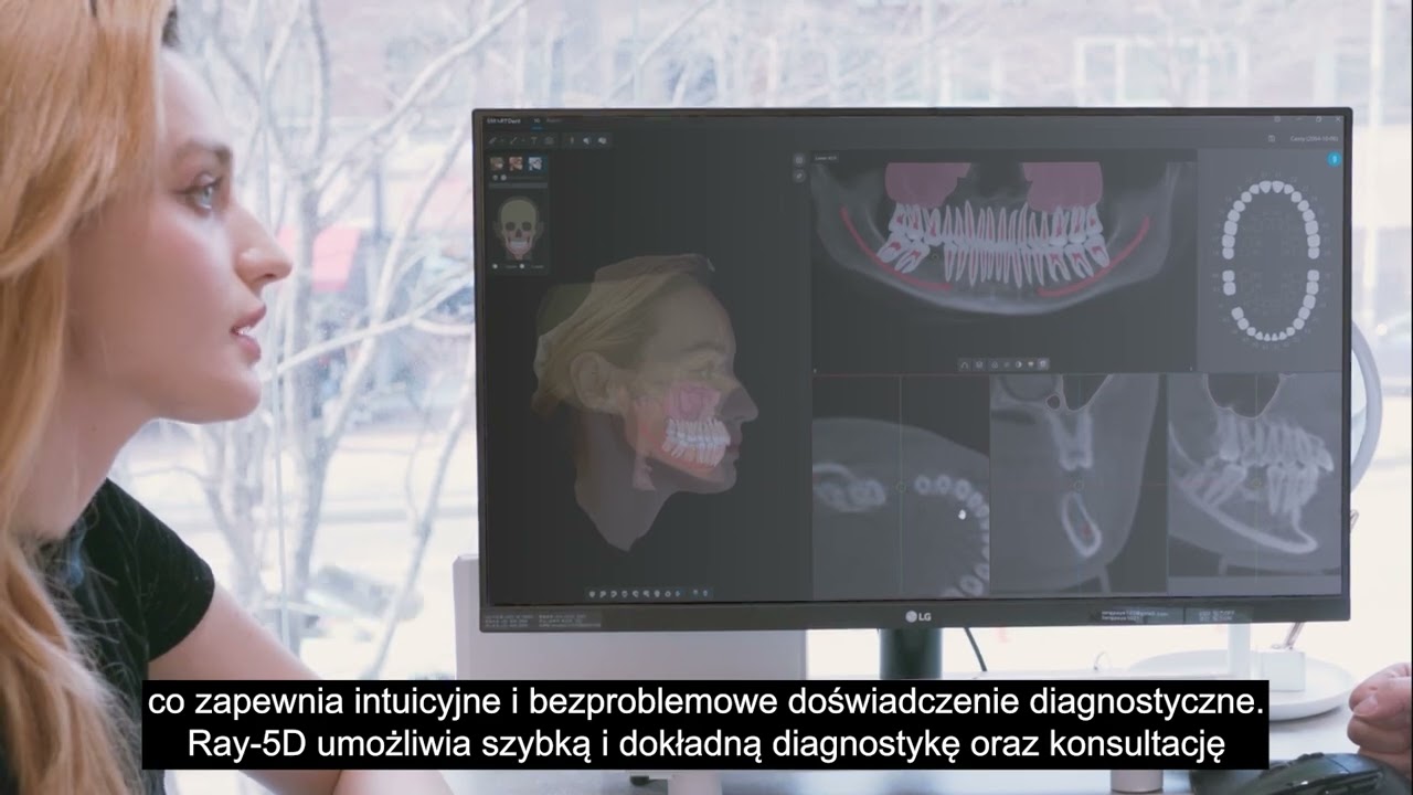 Ray SMARTDent 5D - cechy kluczowe