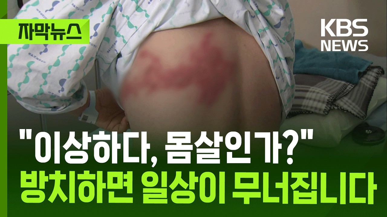 [자막뉴스] 