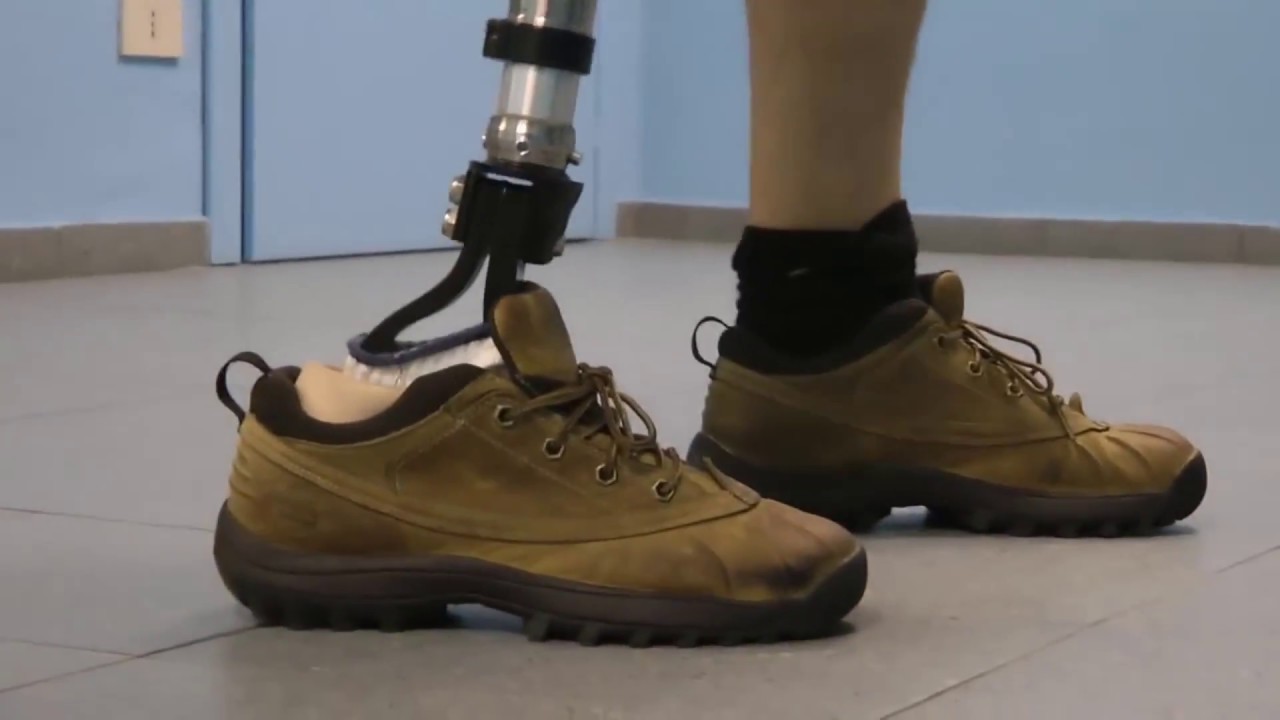 افضل طرف صناعى المانيا تحت الركبة | سوكت كربون dynamic motion foot | قدم متحركة كربون ديناميكي