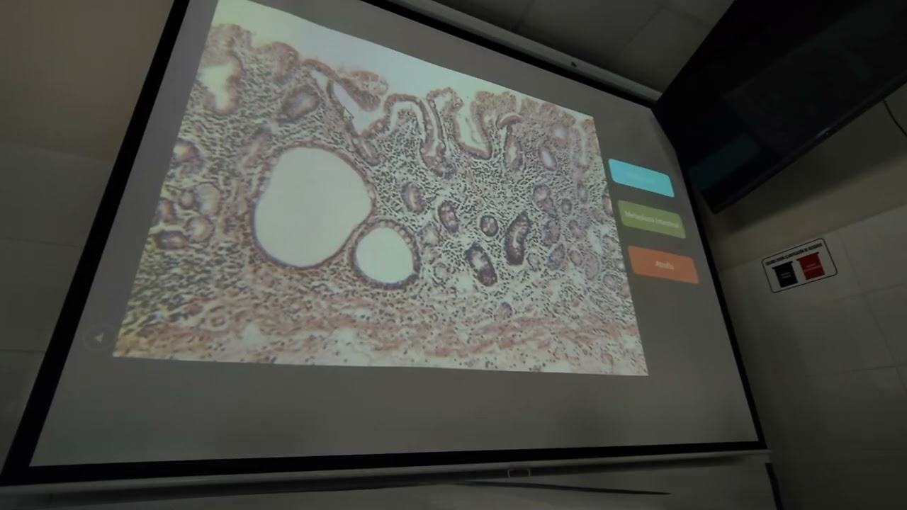 S4 PATO LAB (160426)