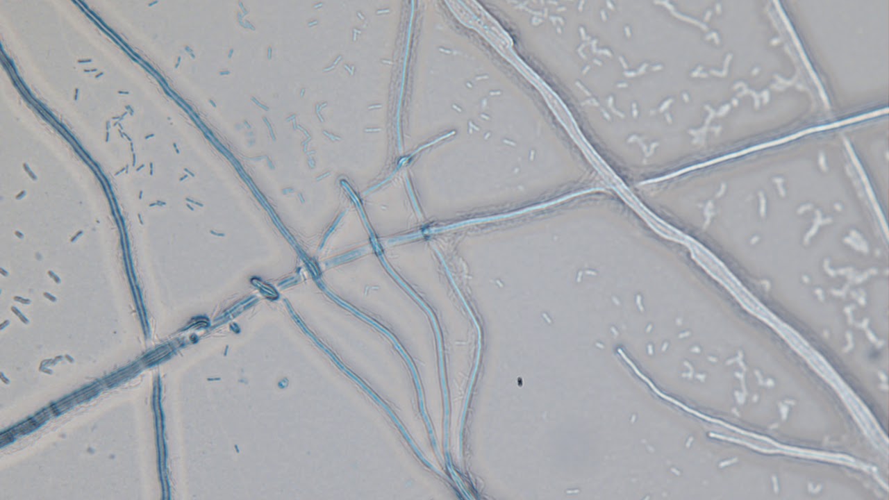 Favolaschia fungal highway