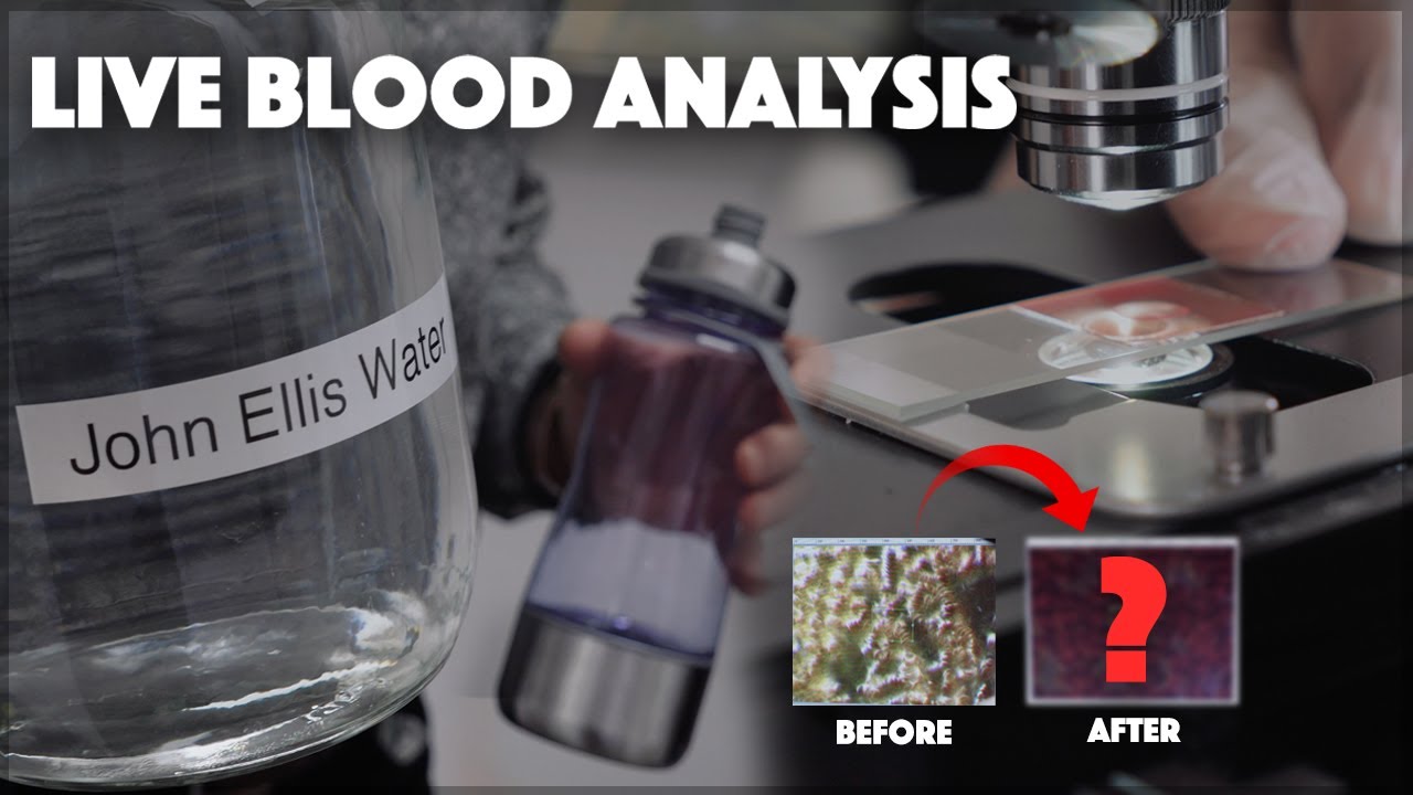 15 Mins Before and After Drinking John Ellis Water | Live Blood Analysis