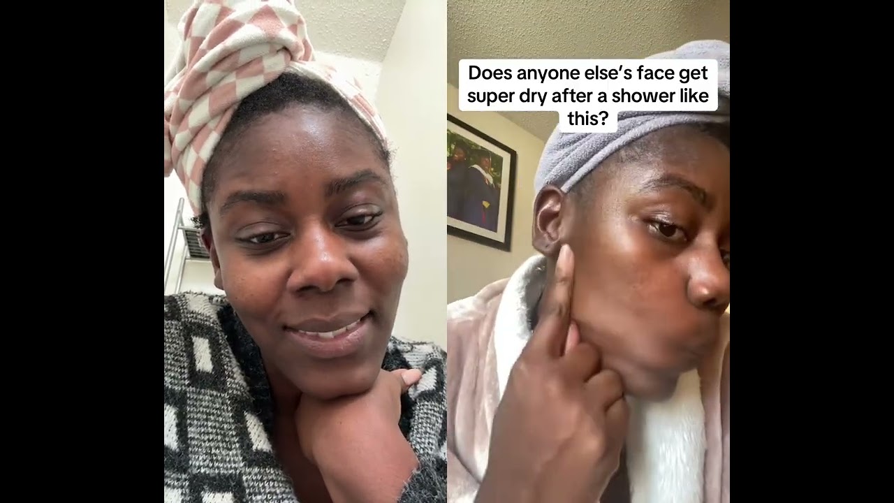 Healed my dry skin | All natural skincare 
