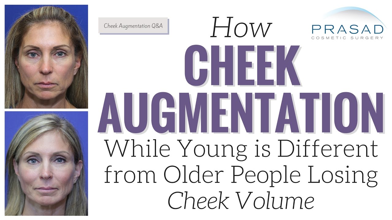 Differences of Cheek Augmentation in Younger People for Correcting Anatomy, and Older People
