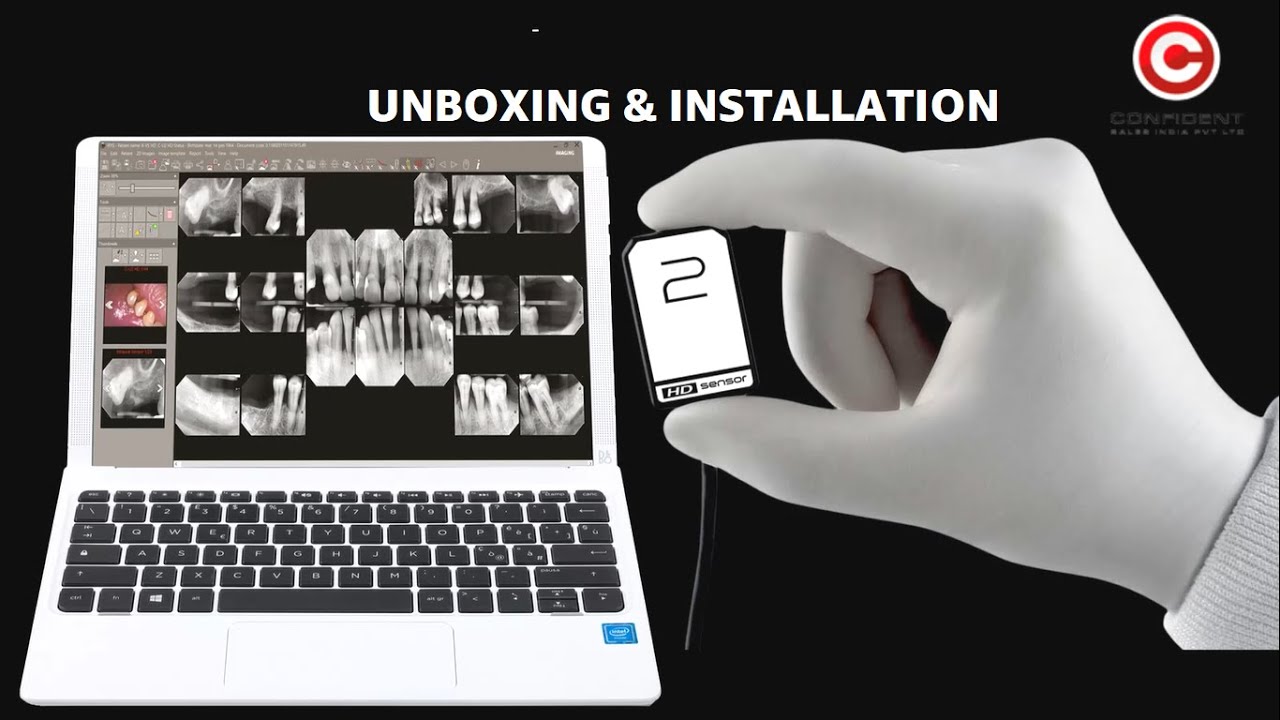 Castellini X-VS RVG Unboxing & Installation | #RVG #radiovisiography #dentalrvg