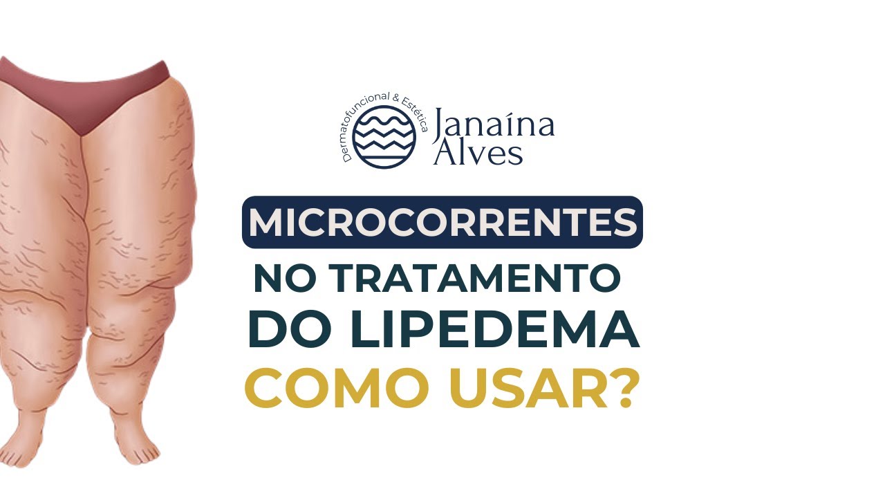 Microcorrentes no tratamento do lipedema, como usar?