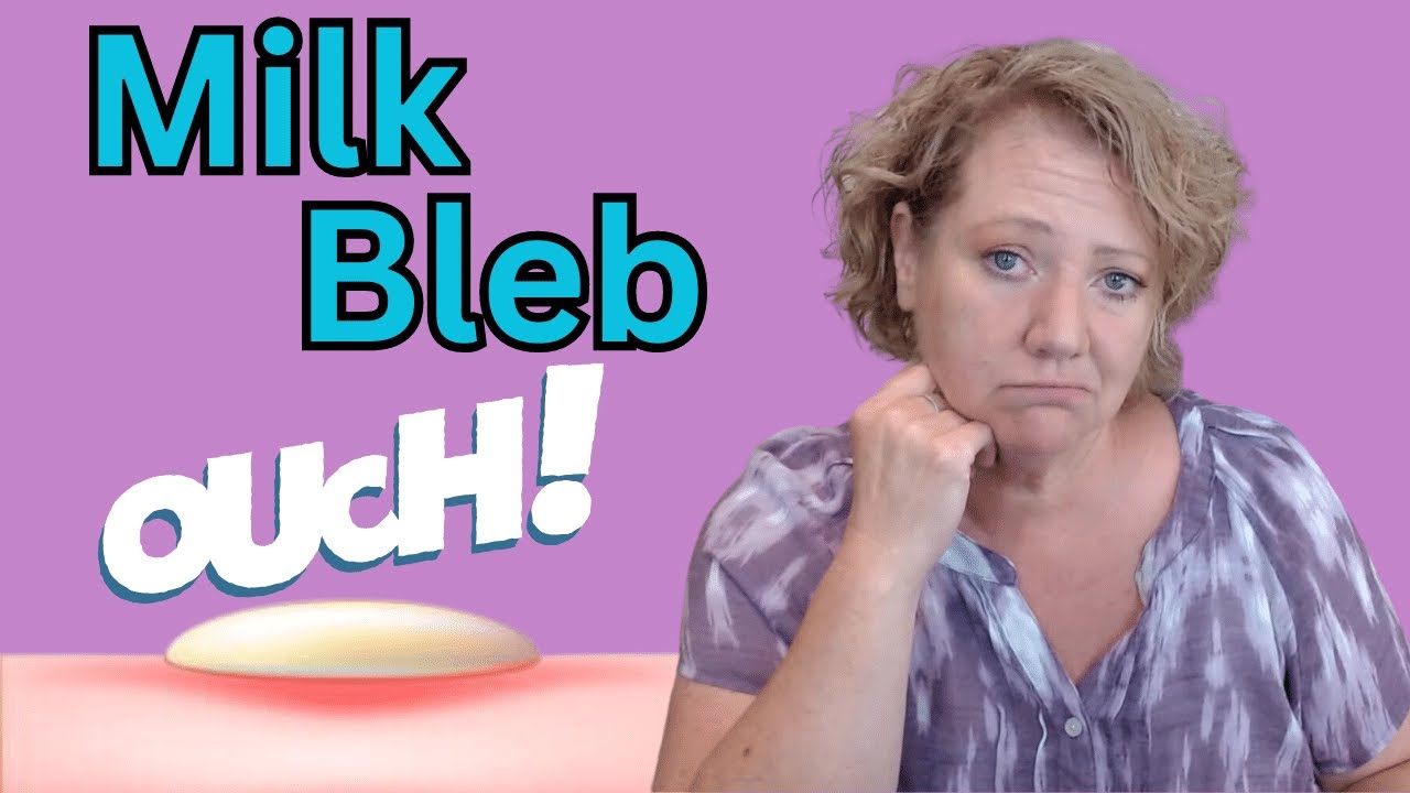Milk Bleb/Blister while breastfeeding