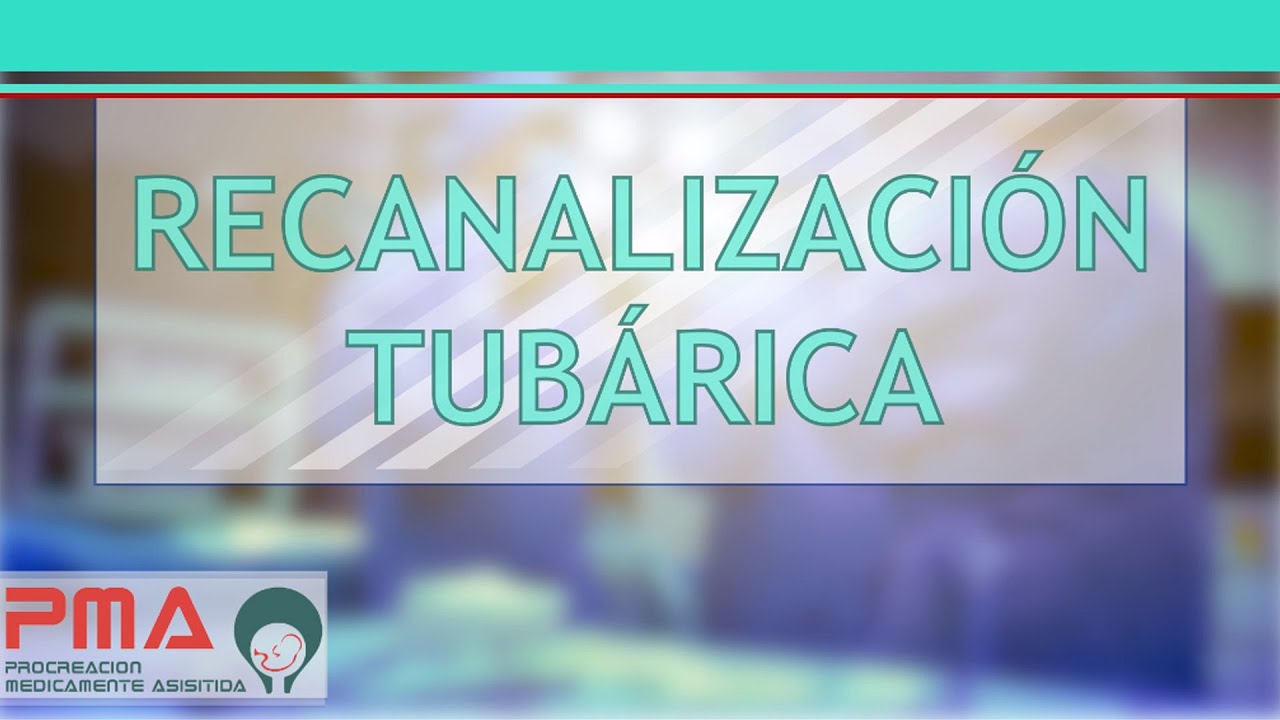 Video Recanalización de trompas - Paso a paso