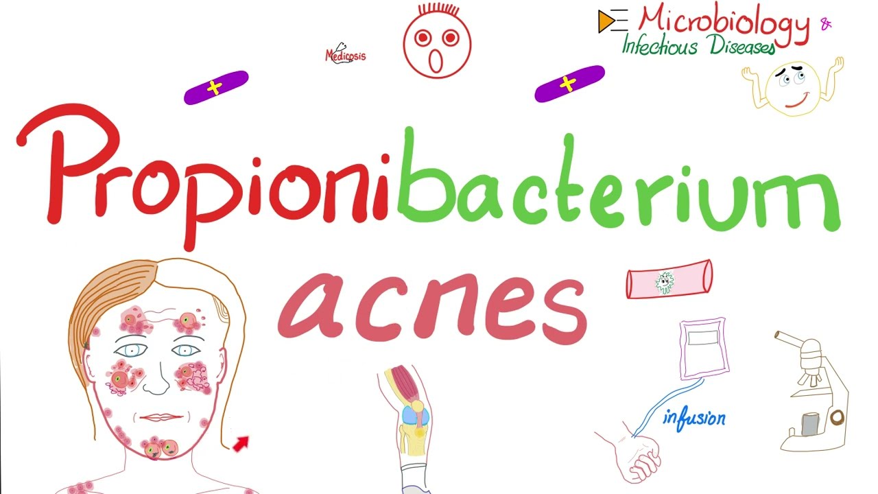 Угри обыкновенные – Propionibacterium acnes – Лечение угрей – Микробиология и инфекционные заболе...